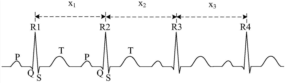 Heart rate analysis method and device based on electrocardiogram