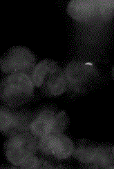 Immuno-fluorescent staining method for detecting mycobacterium tuberculosis in leukocytes and kit