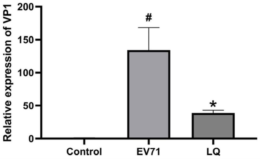 Application of liquiritin in preparation of medicine for treating or preventing enterovirus 71 infection