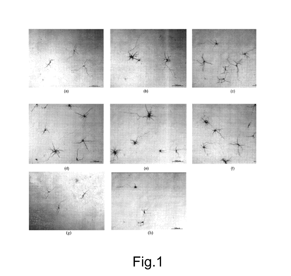 Composition comprising alpha-lipoic acid and honokiol for treating neuropathies