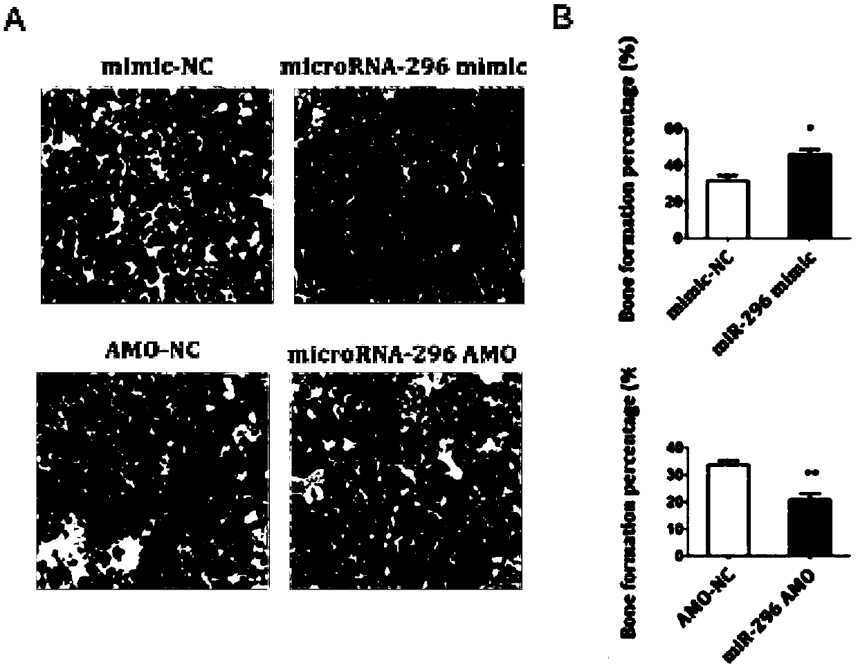 Application of miR-296 and simulant thereof in promoting osteogenic differentiation of bone marrow mesenchymal stem cells and bone formation