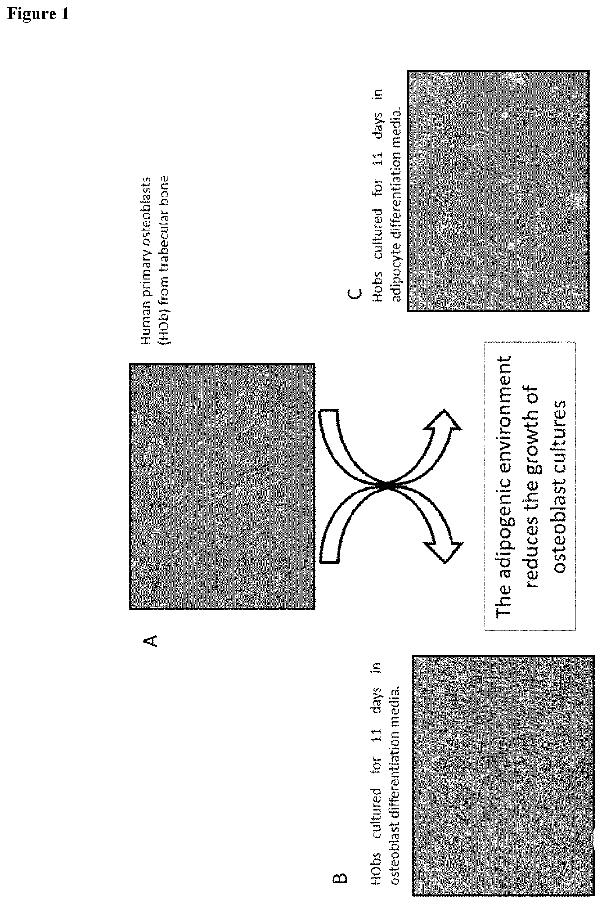 Combinations with thiazolidinediones for use in the prevention or treatment of abnormal bone growth