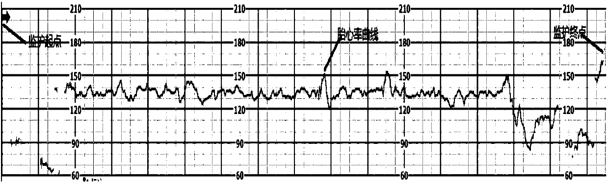 Method for processing fetal heart rate curve data and device thereof