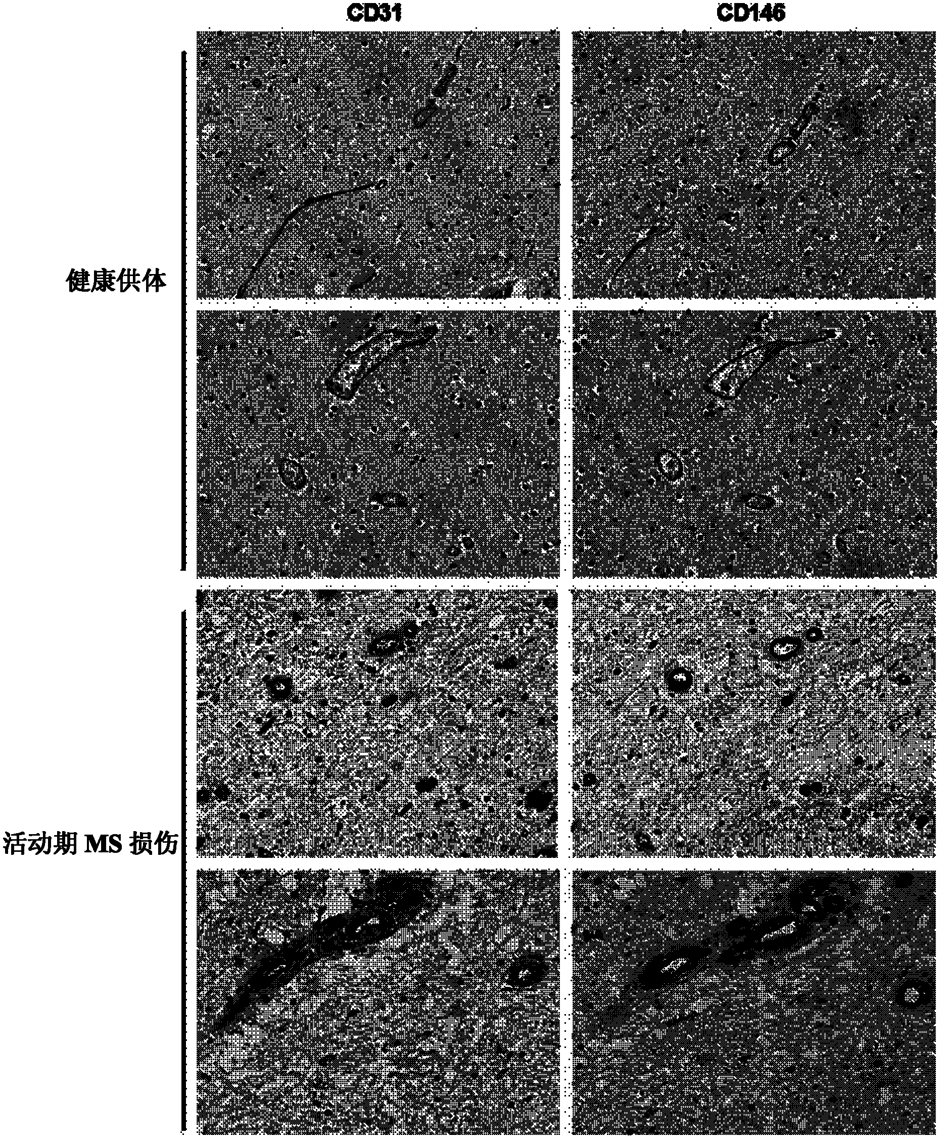 CD (cluster differentiation) 146 and application thereof to antibody diagnosis and treatment for inflammable diseases such as autoimmunity diseases