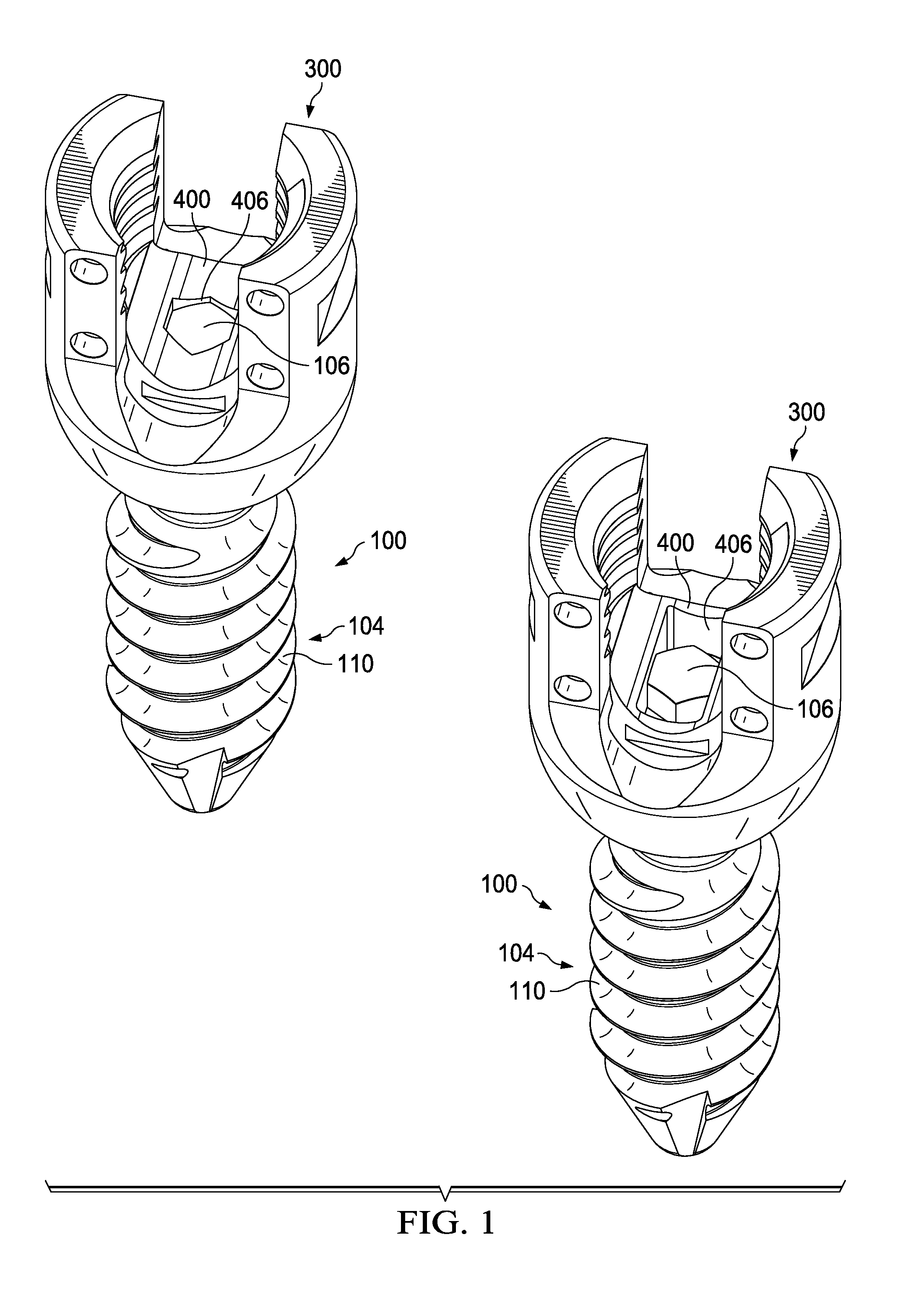 Modular pedicle screw