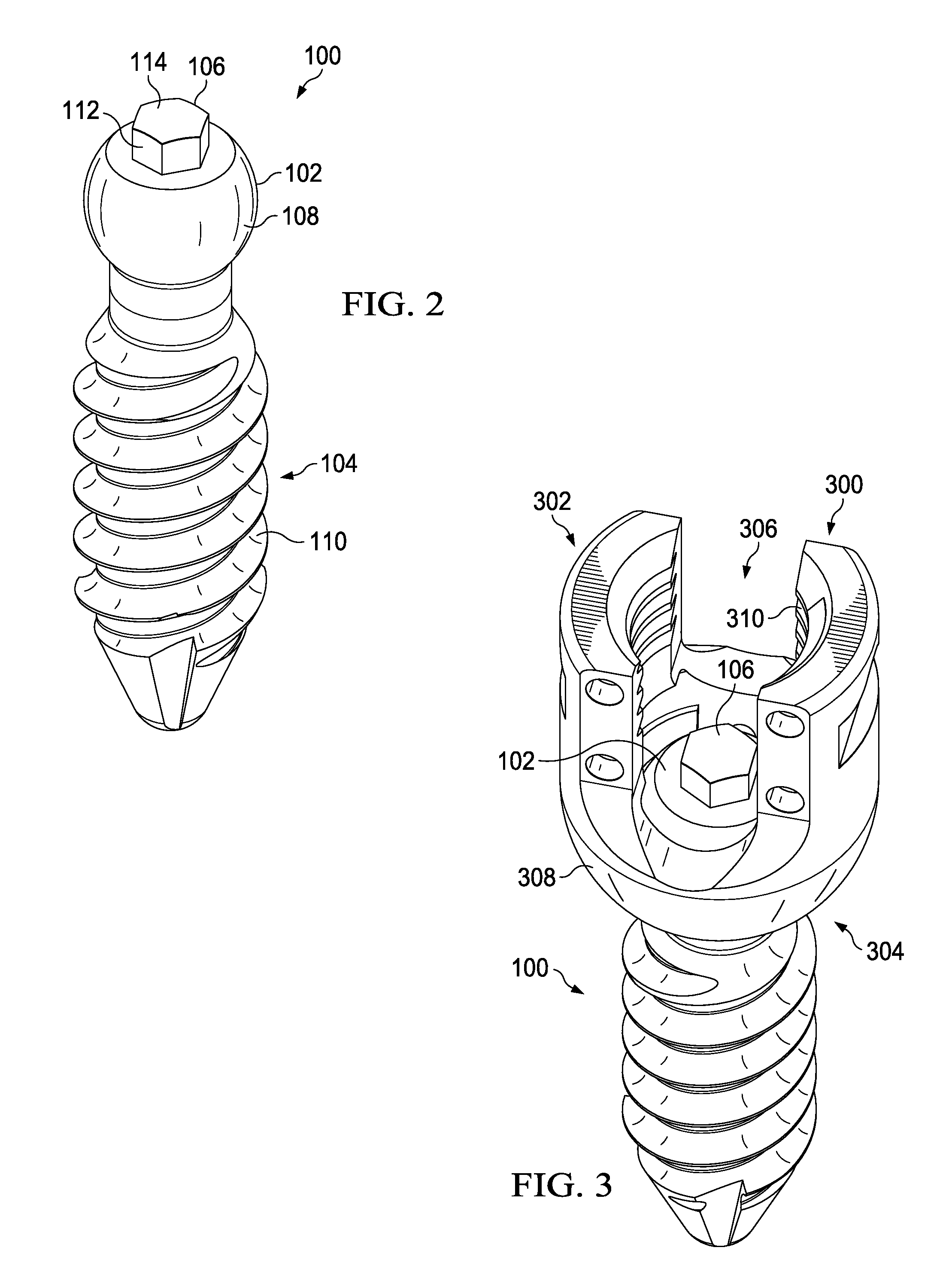 Modular pedicle screw