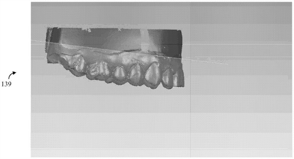 System for preparing teeth for placing veneers