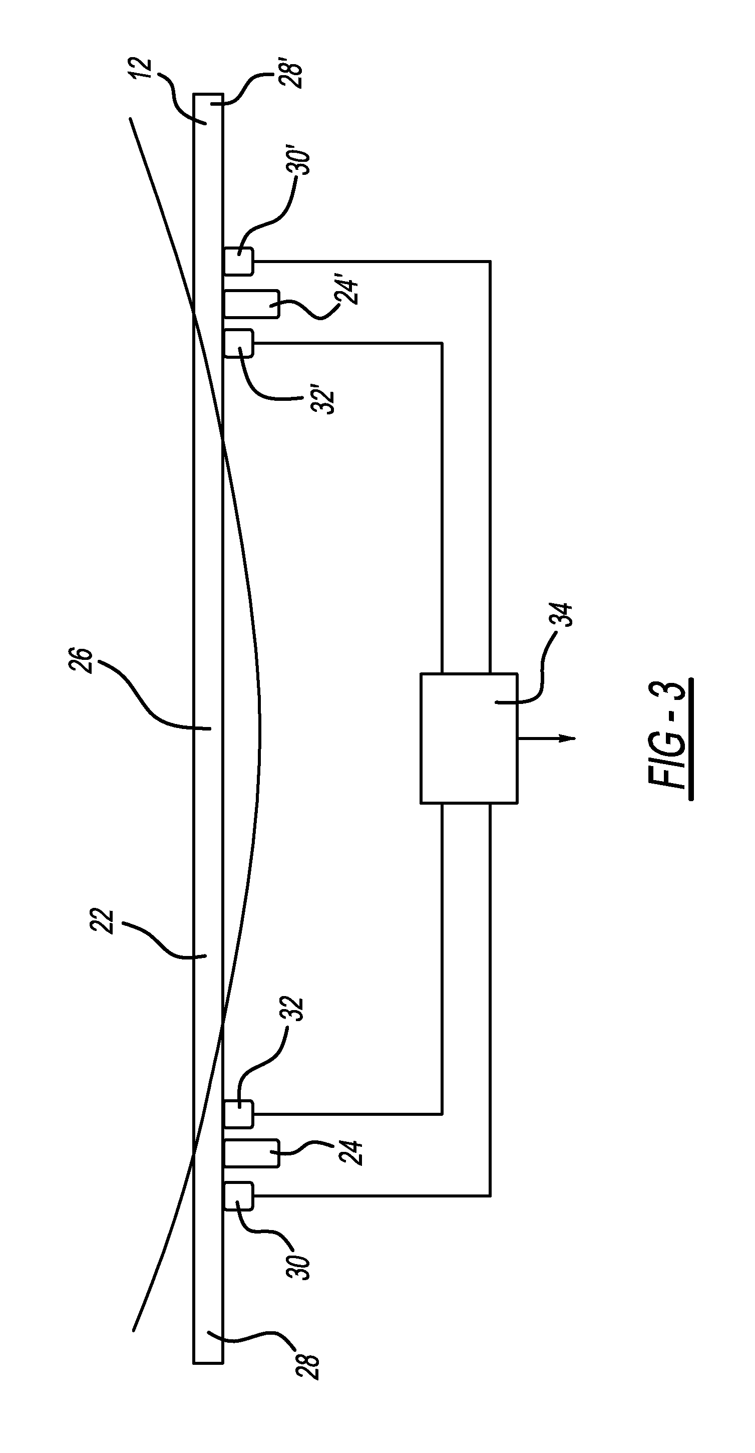 Pedestrian protection sensing system for vehicle having metal bumpers