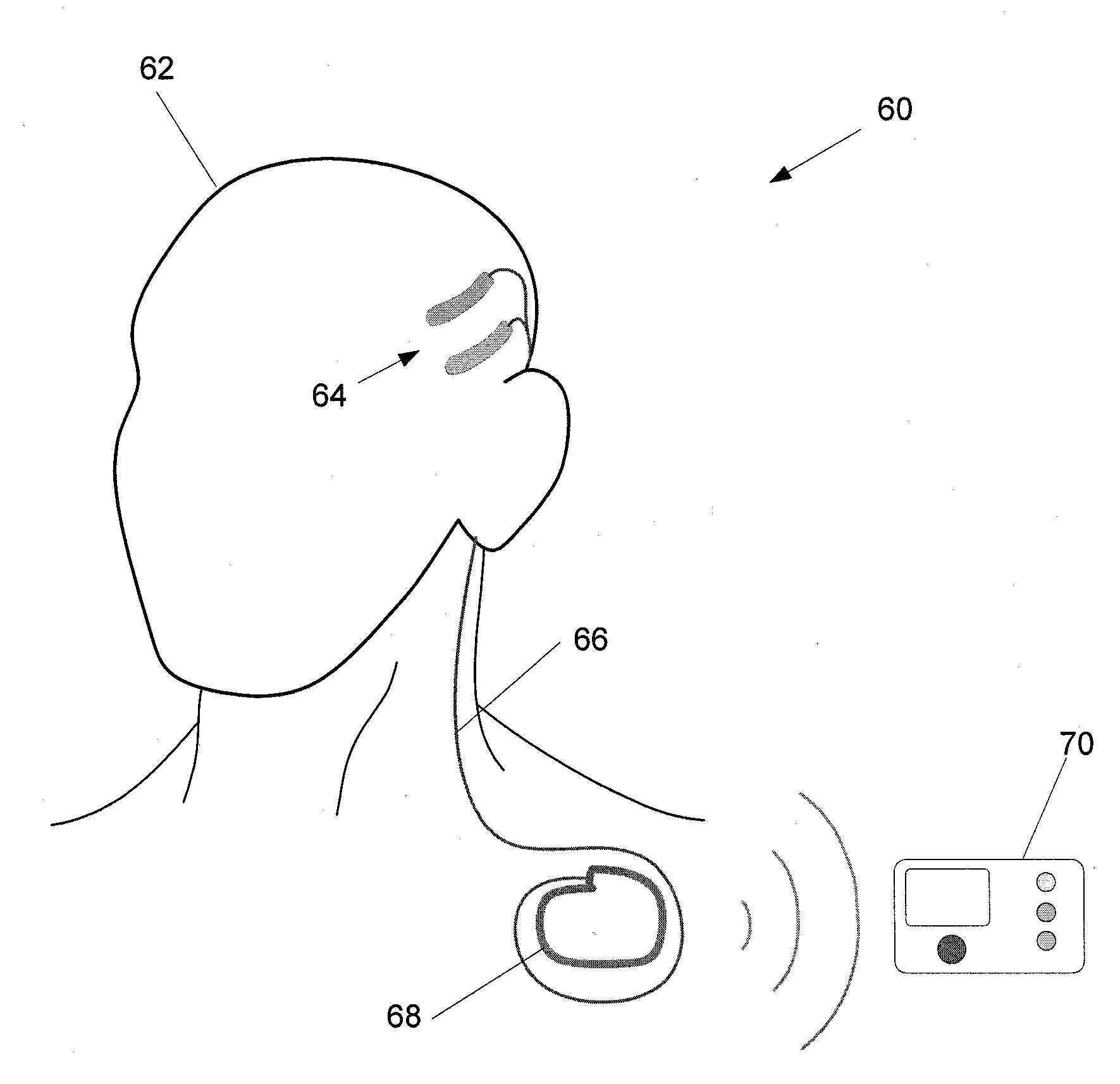 Systems and Methods for Identifying a Contra-ictal Condition in a Subject