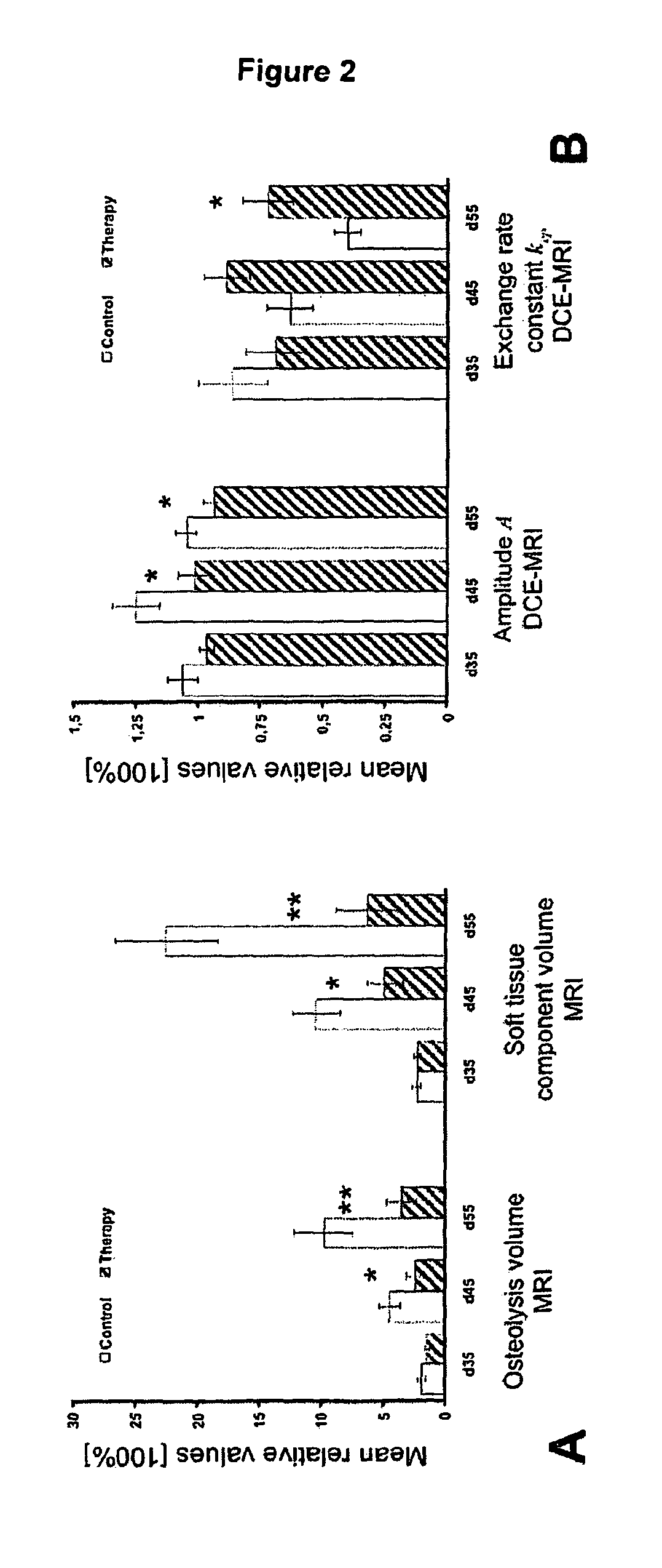 Peptide for Use in the Treatment of Breast Cancer and/or Bone Metastases