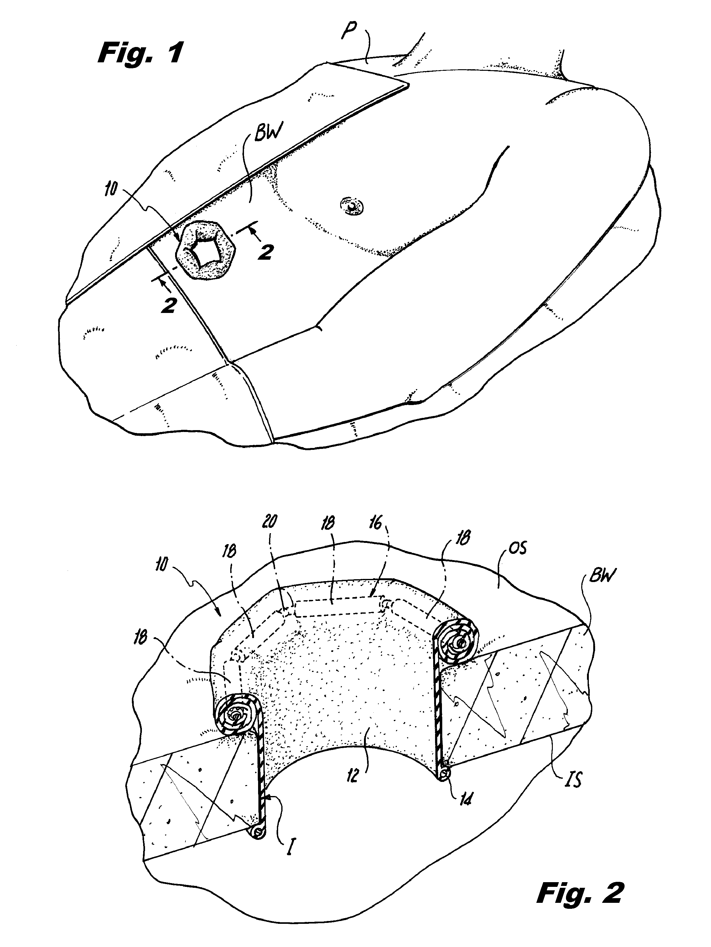 Surgical retractor including polygonal rolling structure