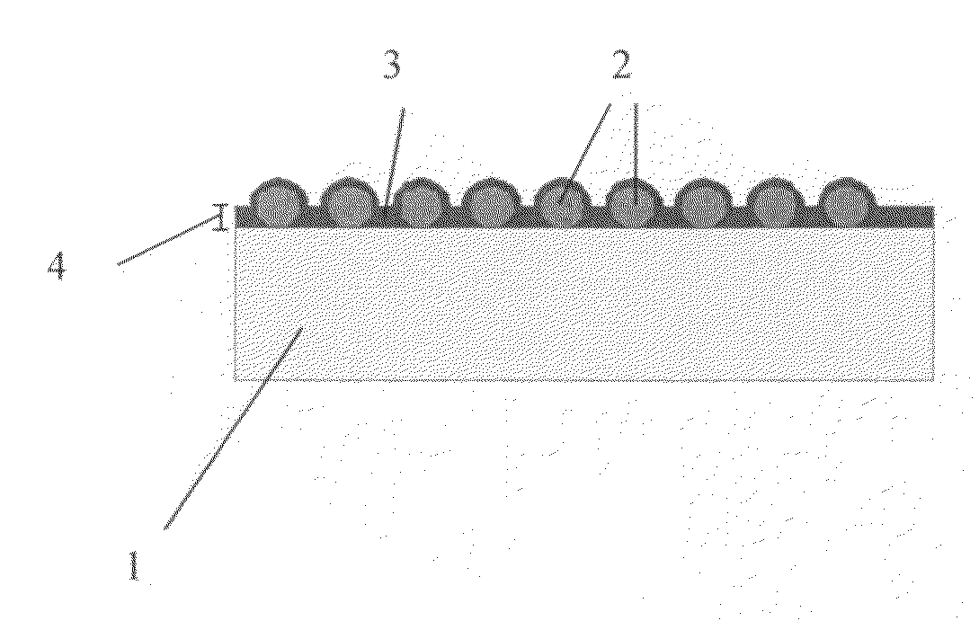 Structured coatings for implants and process for the preparation thereof