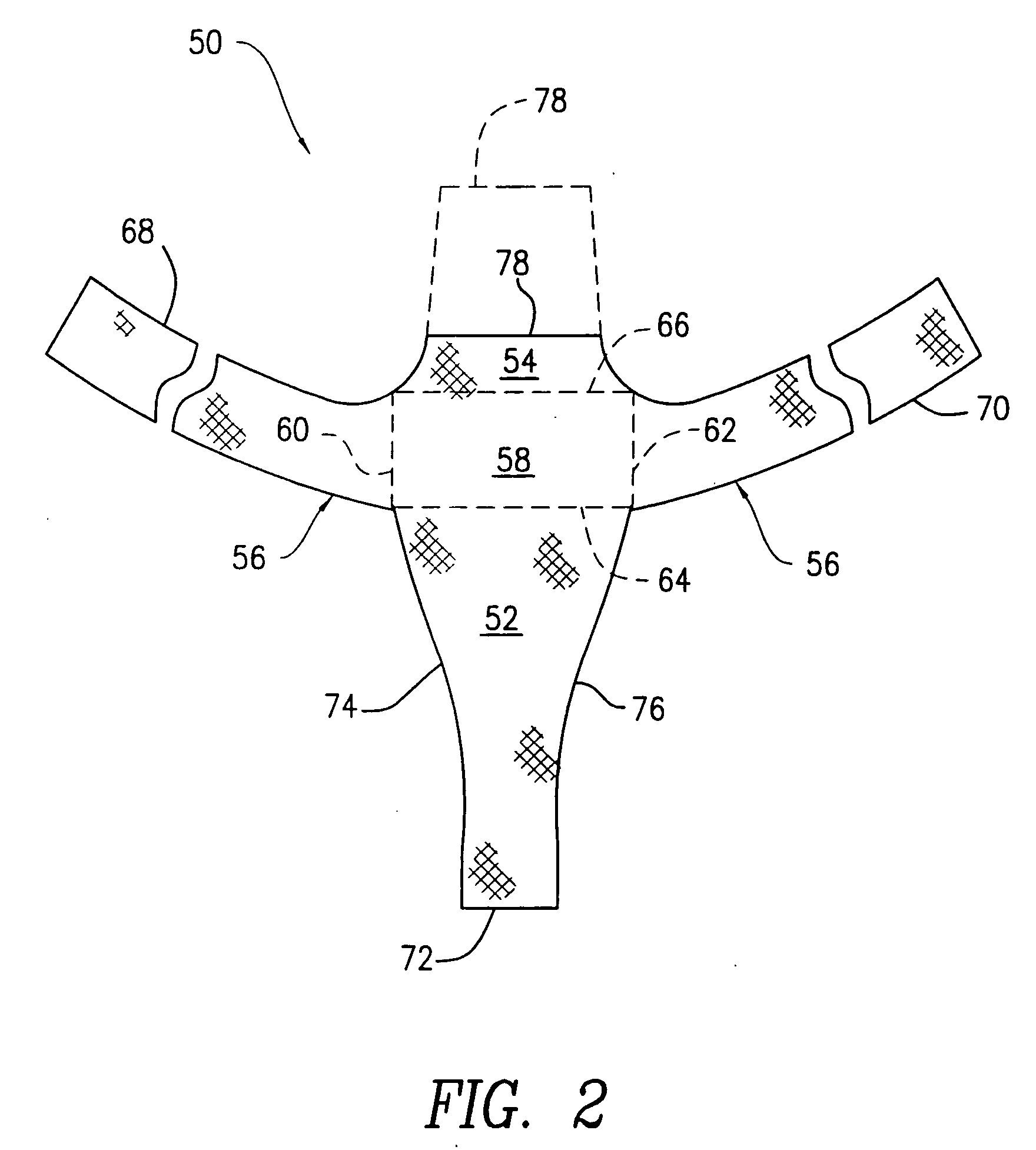 Method and apparatus for treating pelvic organ prolapses in female patients