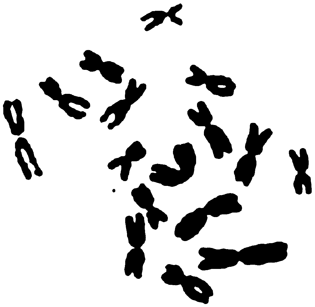Preparation method of planarian chromosome specimen