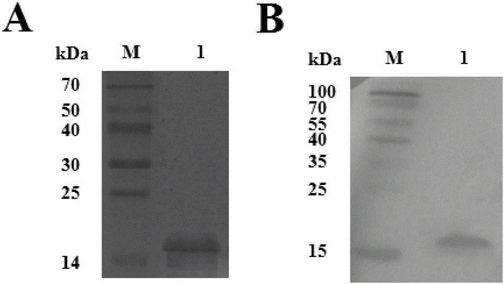 Tussor Yippee gene, and preparation method and application of polyclonal antibody thereof