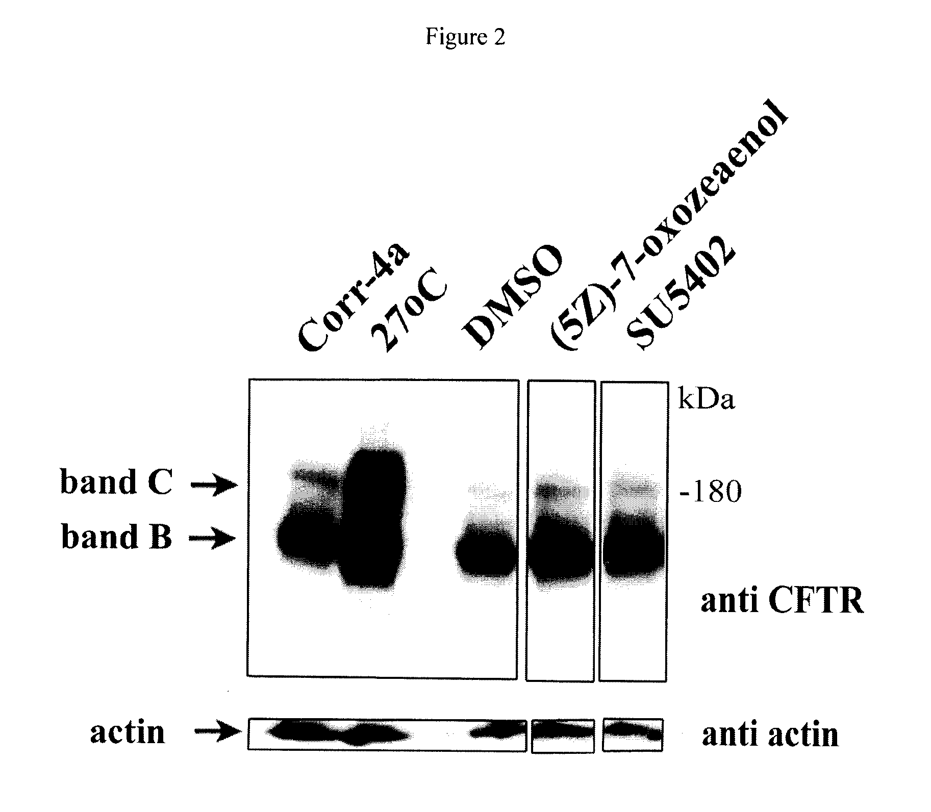 Compositions and methods for treatment of cystic fibrosis and diseases associated with aberrant protein cellular processing