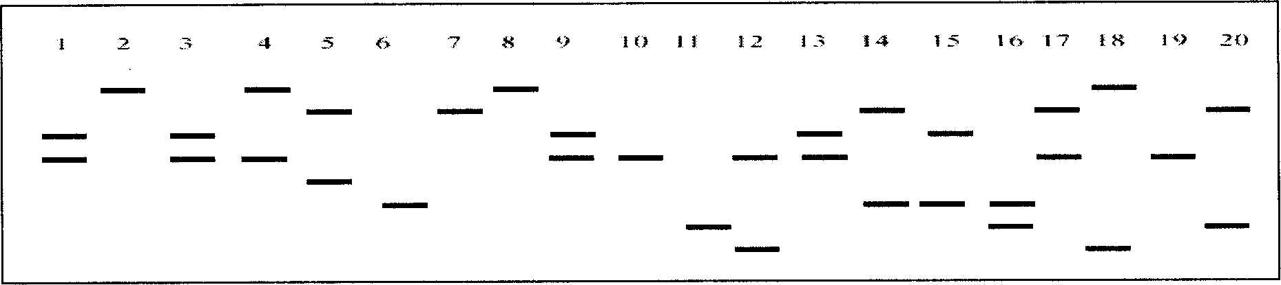 Method for detecting micro-satellite marker LJ_liu of Lateolabrax japonicus