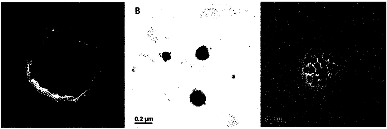 Gold nanoparticle-liposome composite nanoparticles, pharmaceutical composition and applications thereof