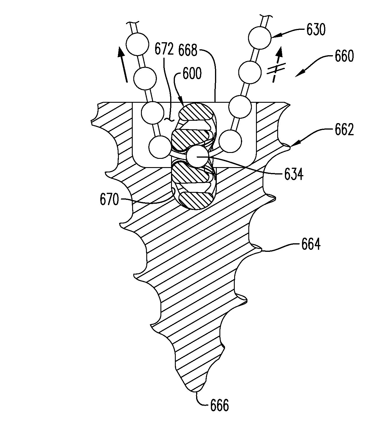 Surgical suture system, tissue restraints, and tissue anchors