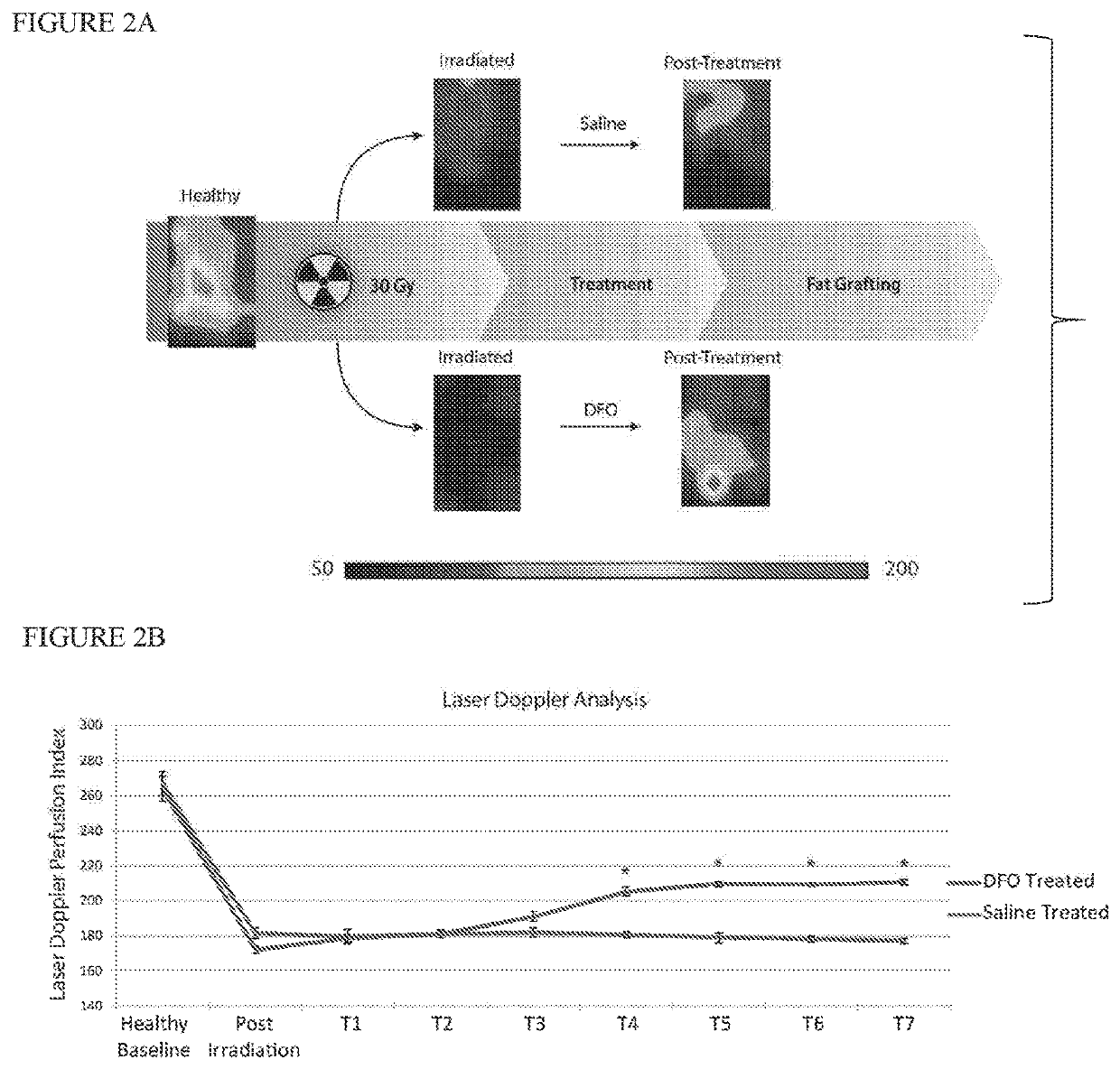 Conditioning irradiated tissue for increasing vascularity