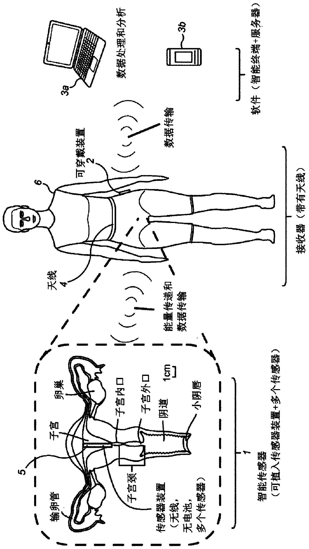 Wearable antenna and intra-uterine monitoring system