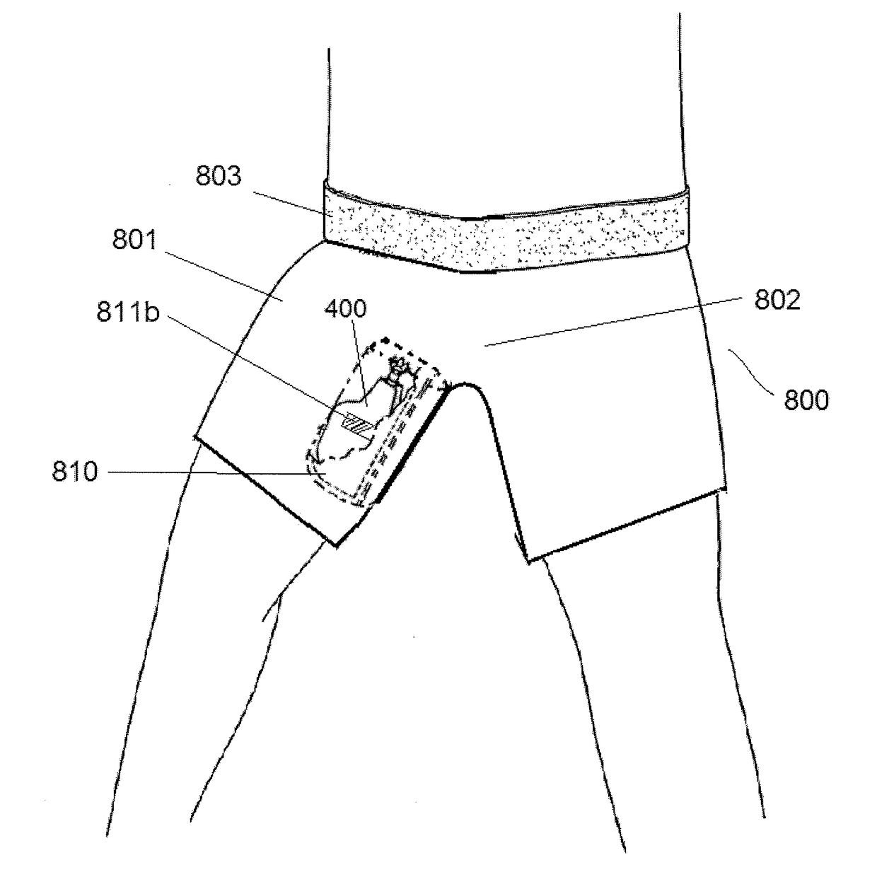 Incontinence collection device and related methods