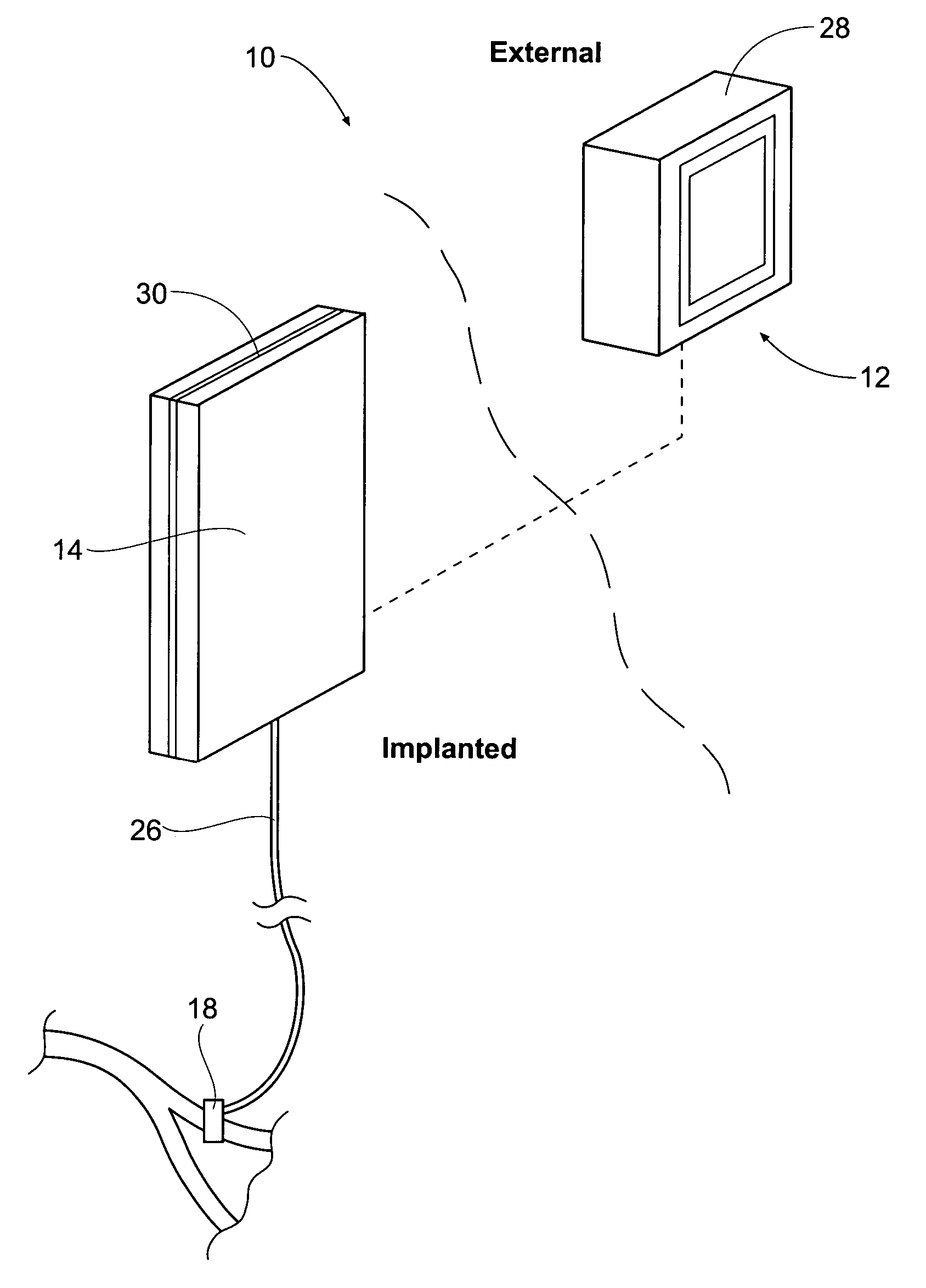 Methods for stimulating components in, on, or near the pudendal nerve or its branches to achieve selective physiologic responses