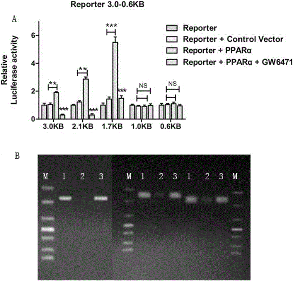 Direct regulation and control effect of peroxisome proliferator-activated receptor alpha on carnitine palmityl transferase 1C, and antitumor application