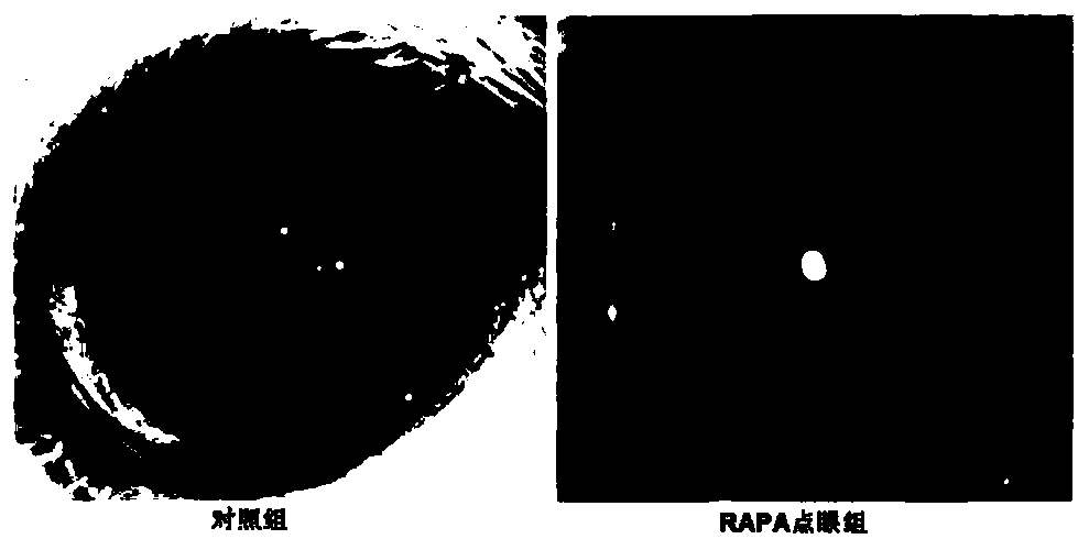 A kind of rapamycin nano micellar eye drops and preparation method thereof