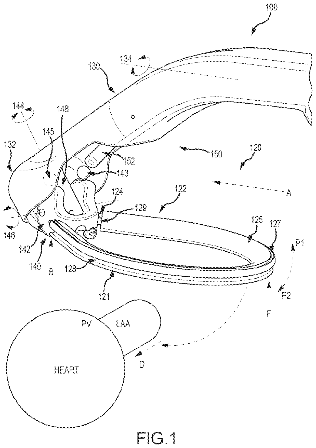 Systems and methods for left atrial appendage closure
