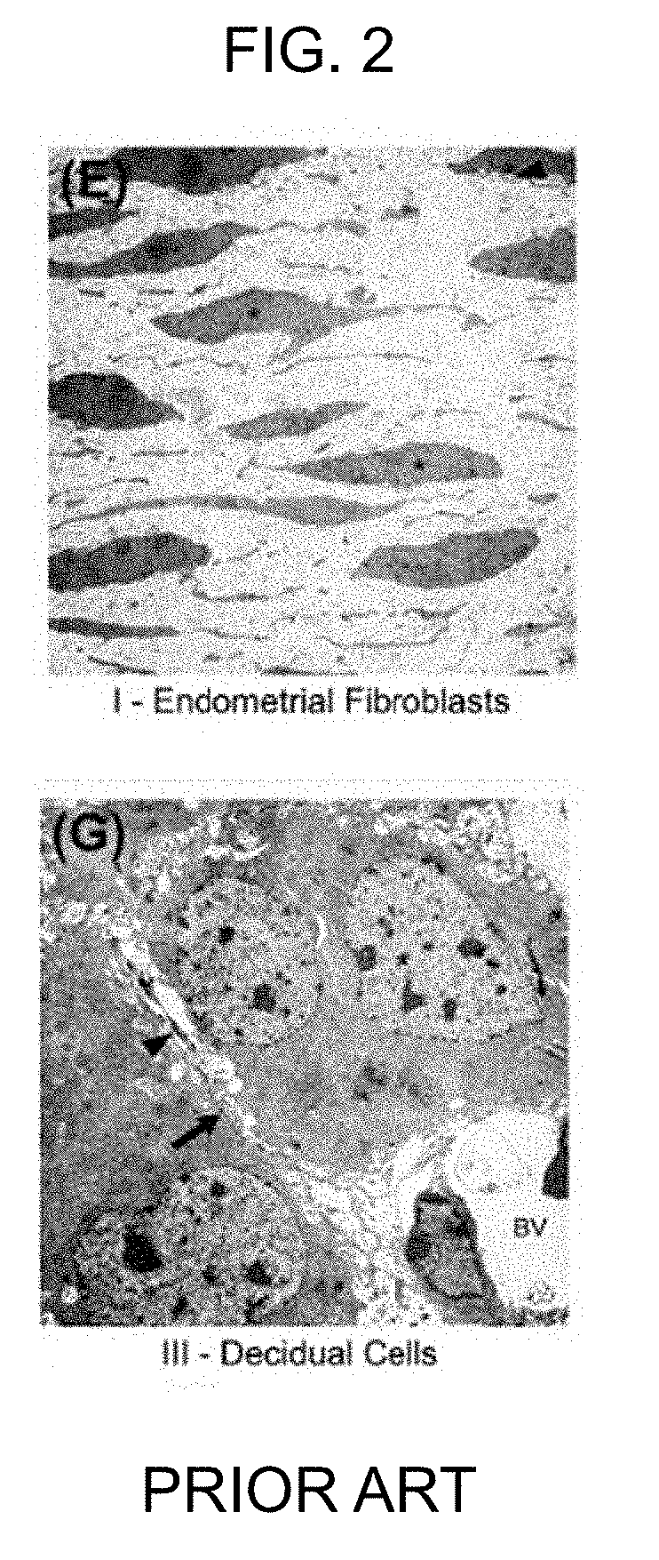 Compositions and methods for inhibiting autophagy and contraception