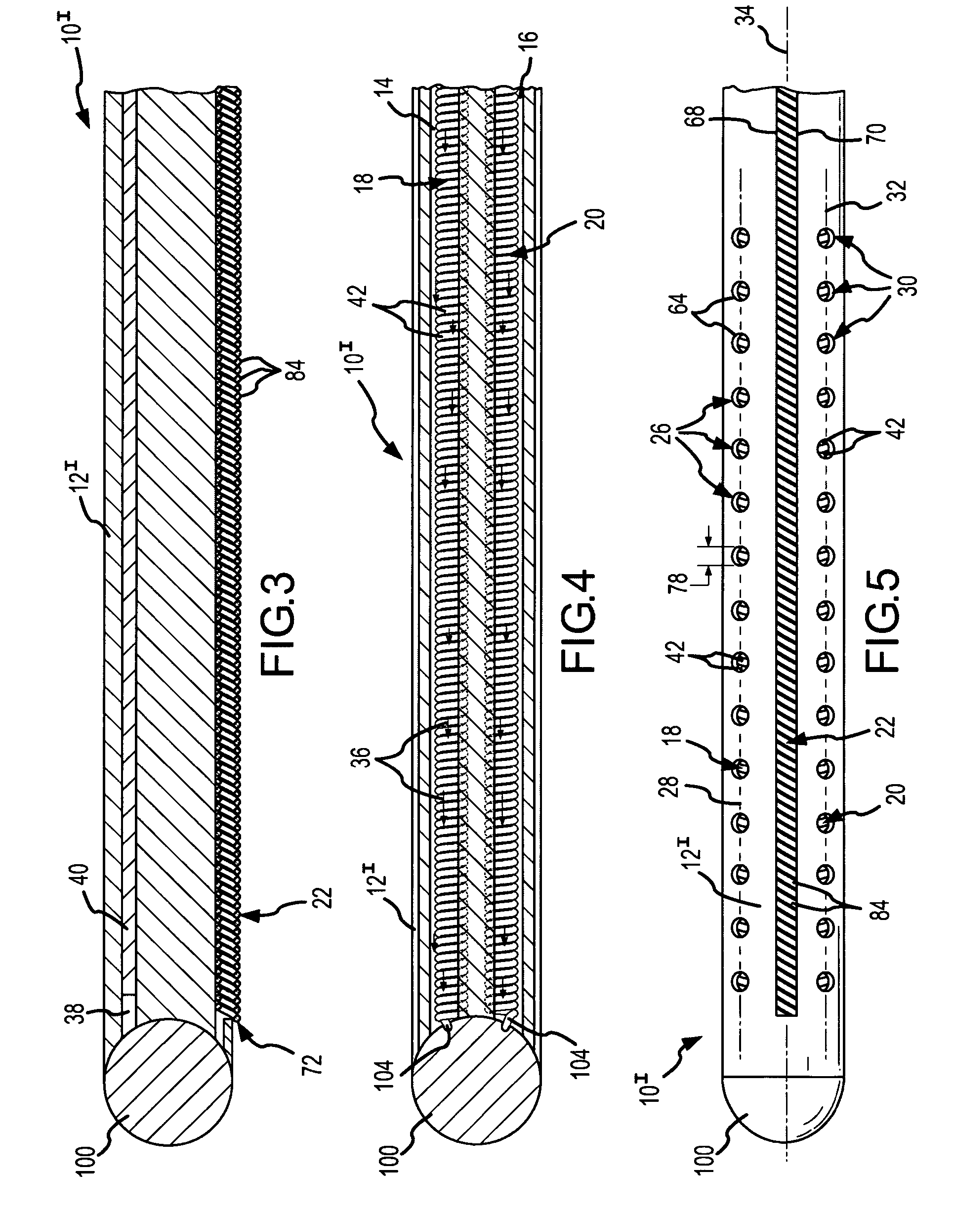 Multipolar, multi-lumen, virtual-electrode catheter with at least one surface electrode and method for ablation