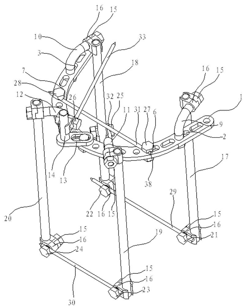 Combined ankle joint three-dimensional traction fixation frame