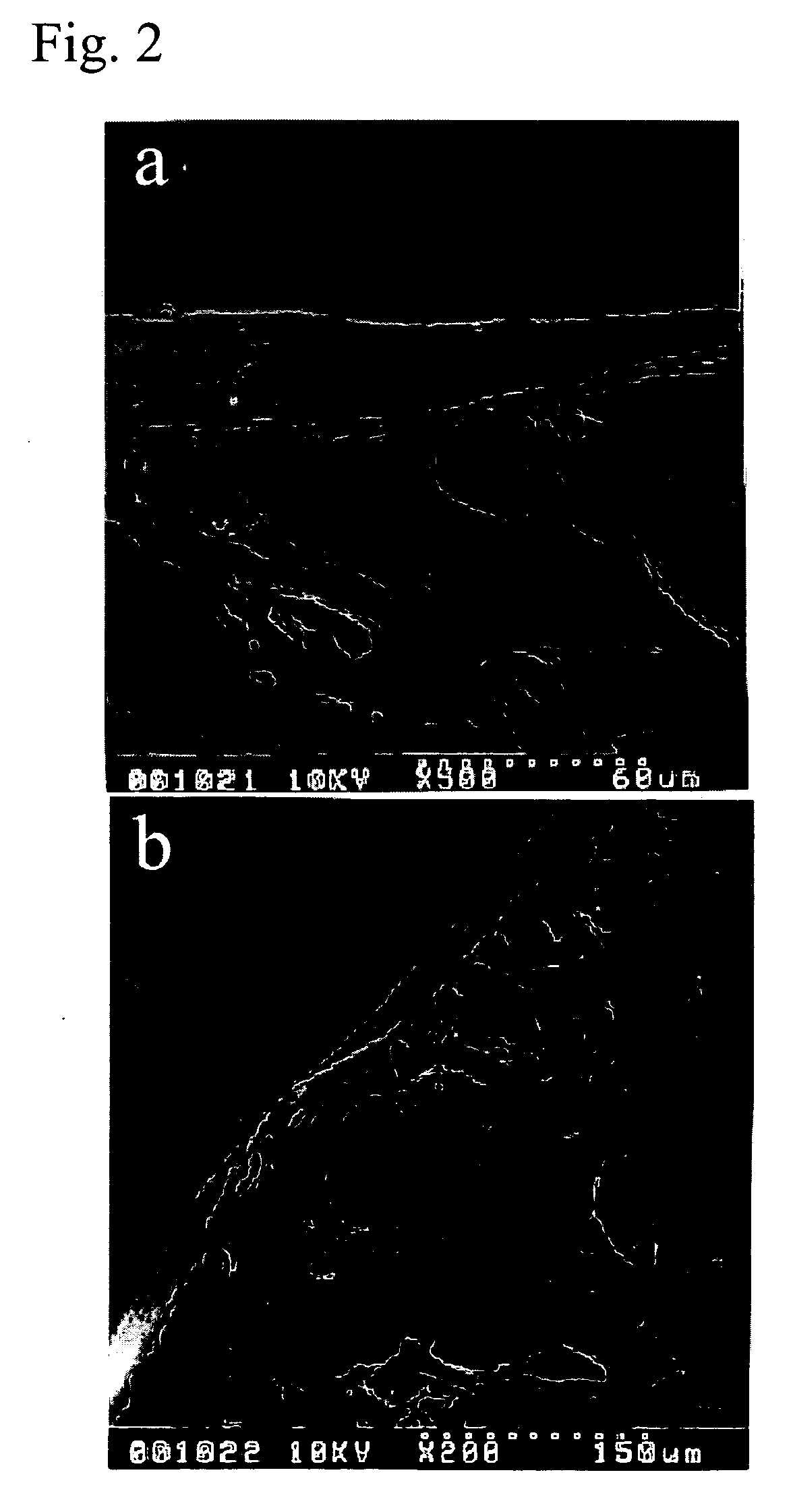Dermal substitute consisting of amnion and biodegradable polymer, the preparation method and the use thereof