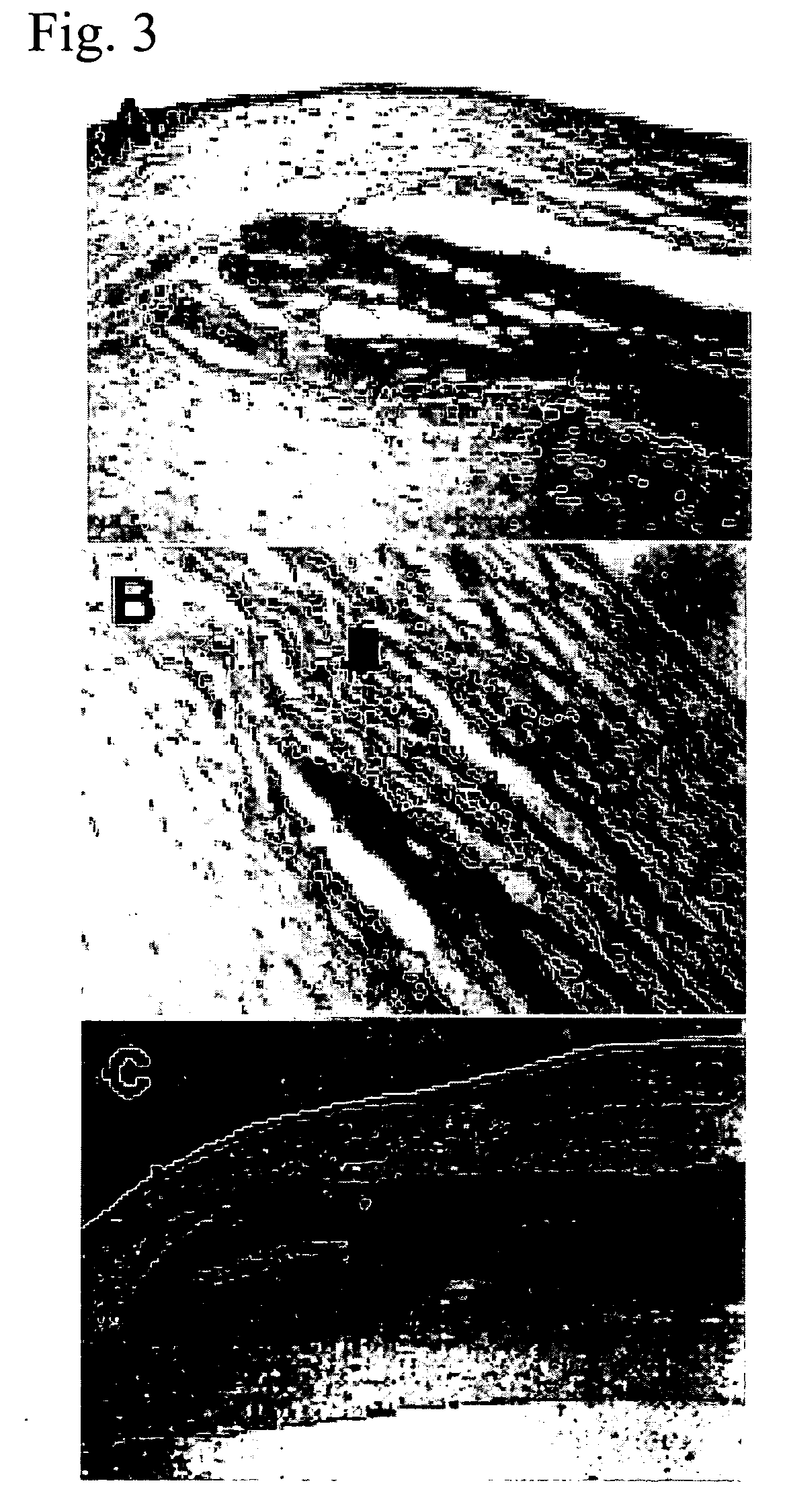 Dermal substitute consisting of amnion and biodegradable polymer, the preparation method and the use thereof