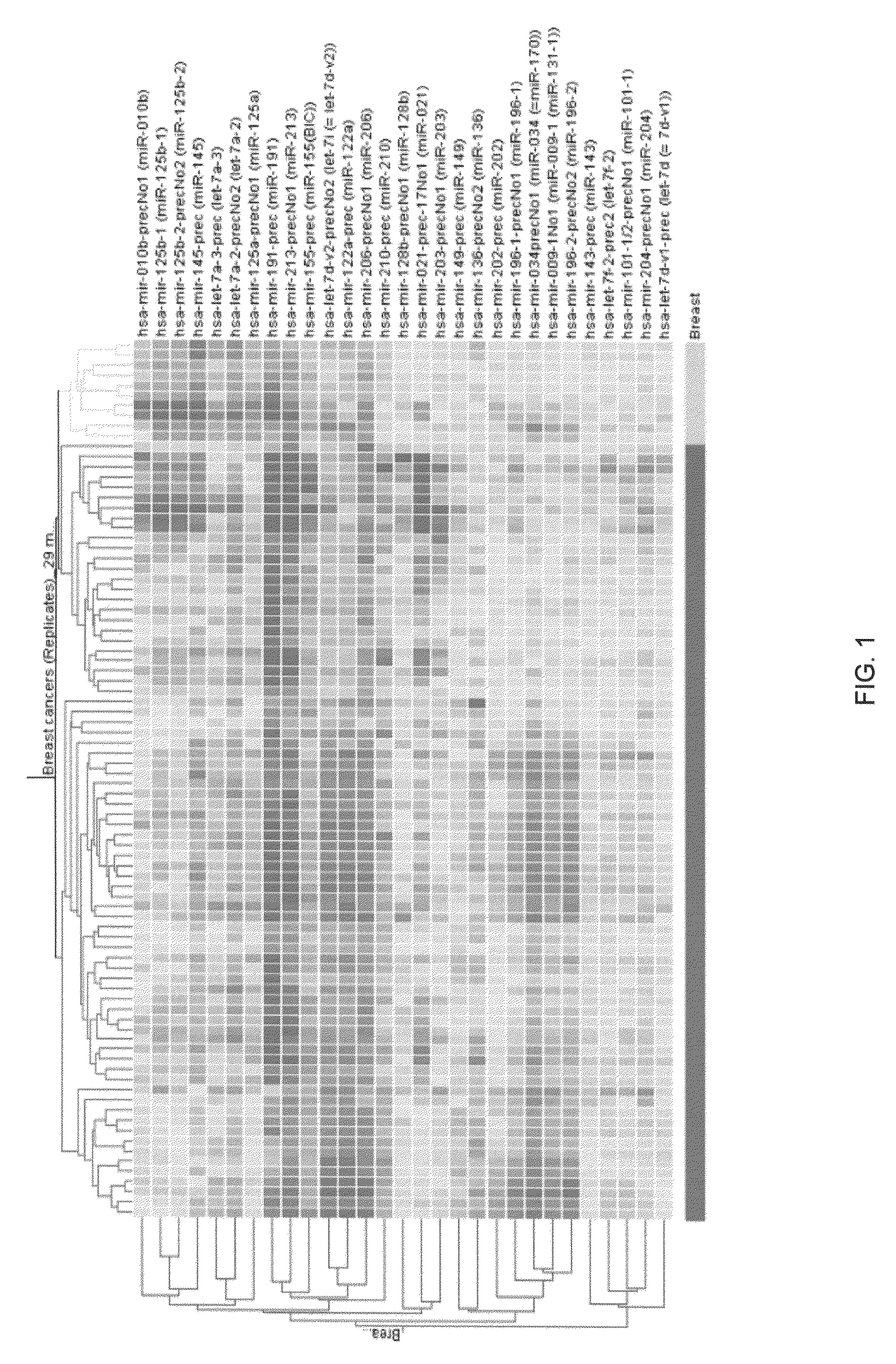 MicroRNA-based methods and compositions for the diagnosis, prognosis and treatment of breast cancer
