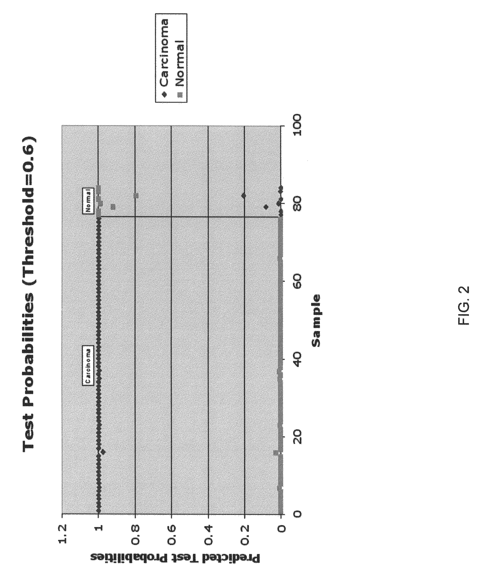 MicroRNA-based methods and compositions for the diagnosis, prognosis and treatment of breast cancer