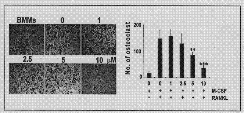 Use of crataegolic acid and derivatives thereof in preparation of therapeutic and/or preventive medicines for inhibiting osteoclast differentiation and function