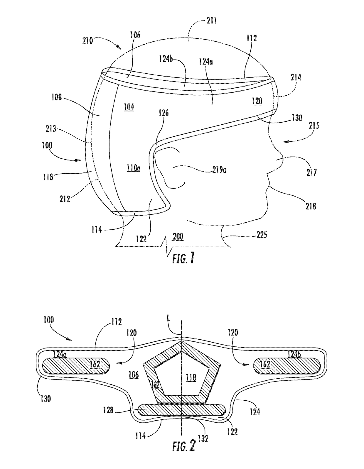 Force distribution method and apparatus for neonates at risk of cranial molding