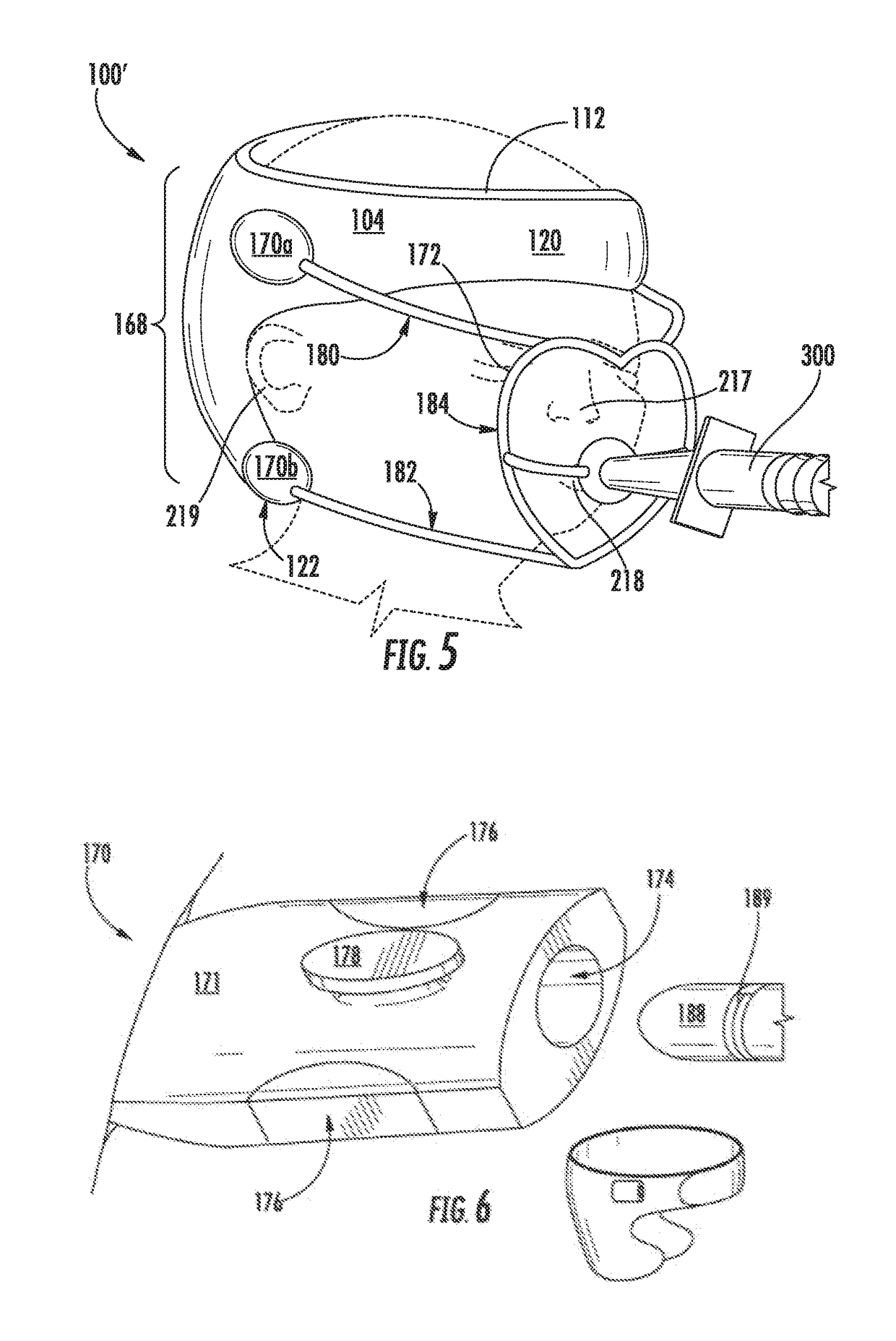 Force distribution method and apparatus for neonates at risk of cranial molding