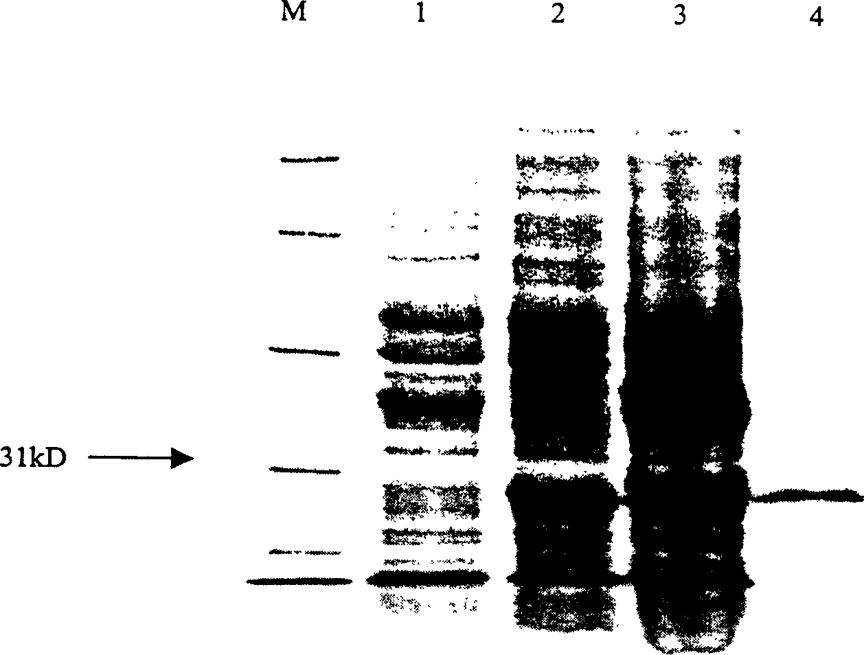 GST fusion expression of conotoxin MVII A gene and its use
