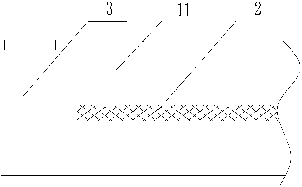 Detachable placing frame