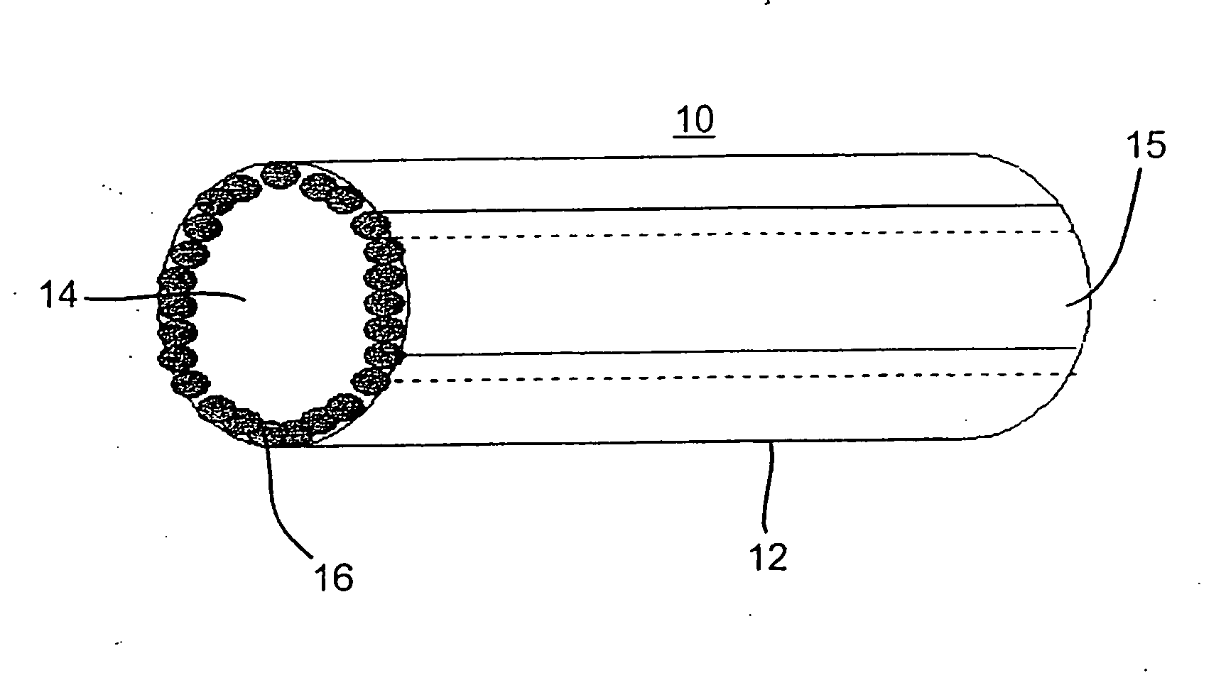 Artificial vascular grafts, their construction and use