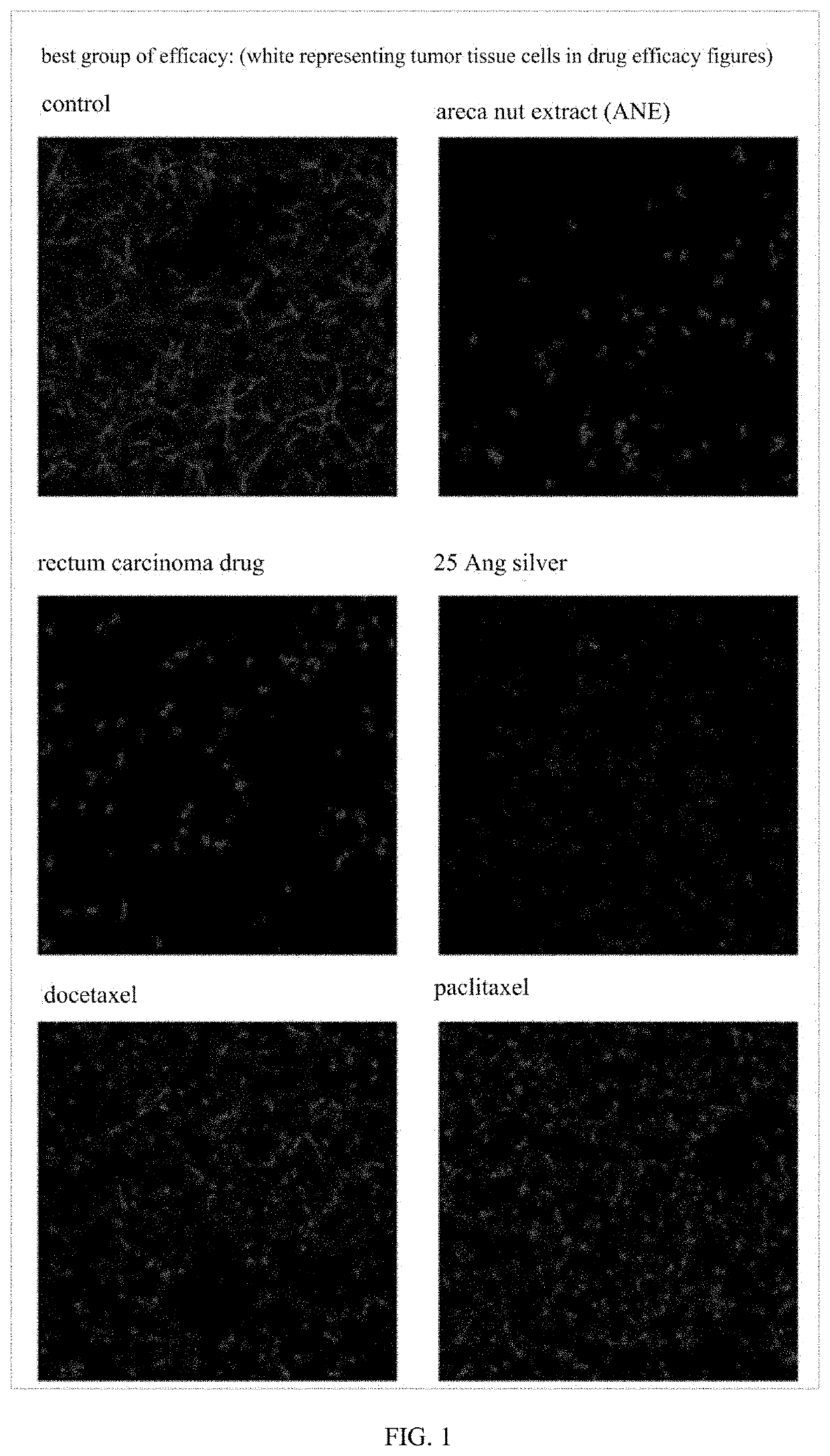 Angstrom silver injection for cancer inhibition, preparation method and application thereof