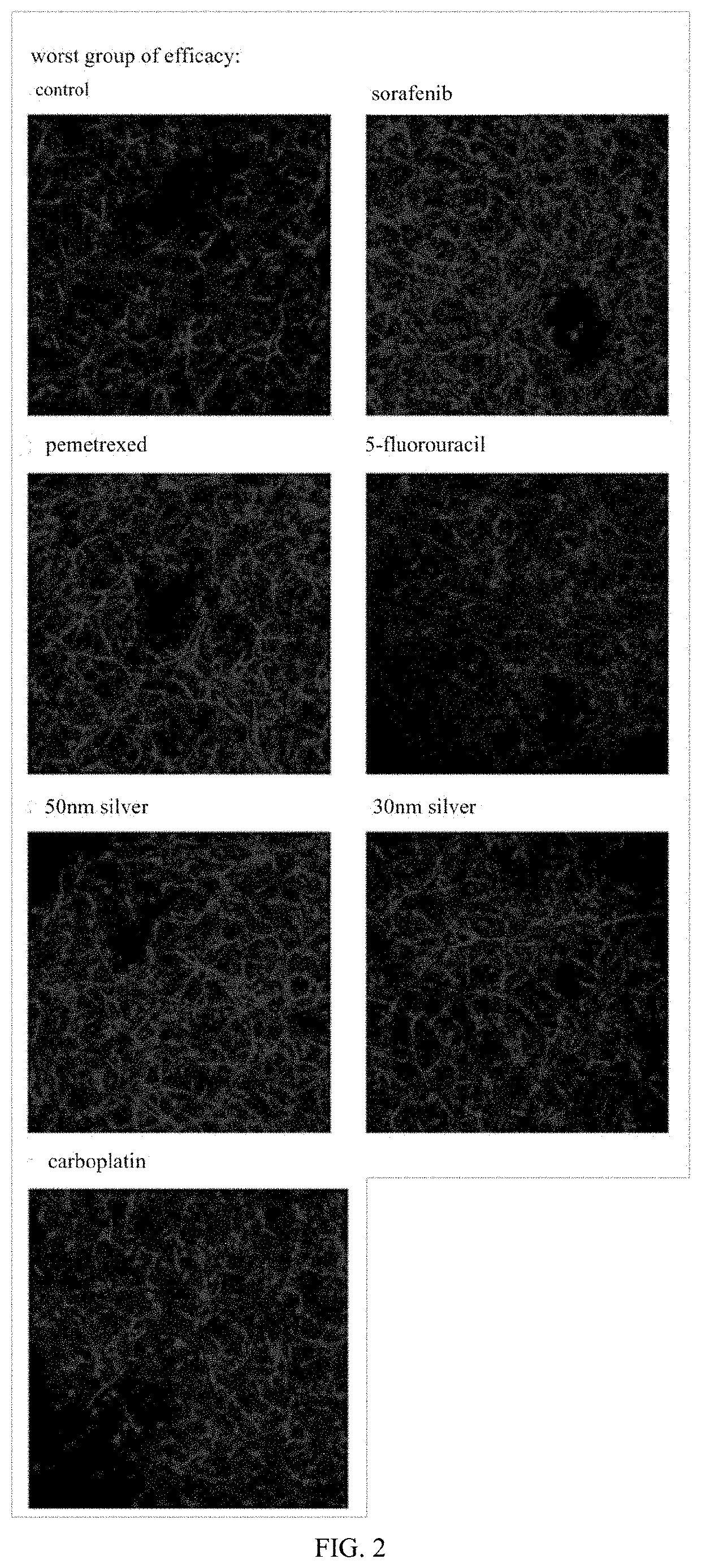 Angstrom silver injection for cancer inhibition, preparation method and application thereof