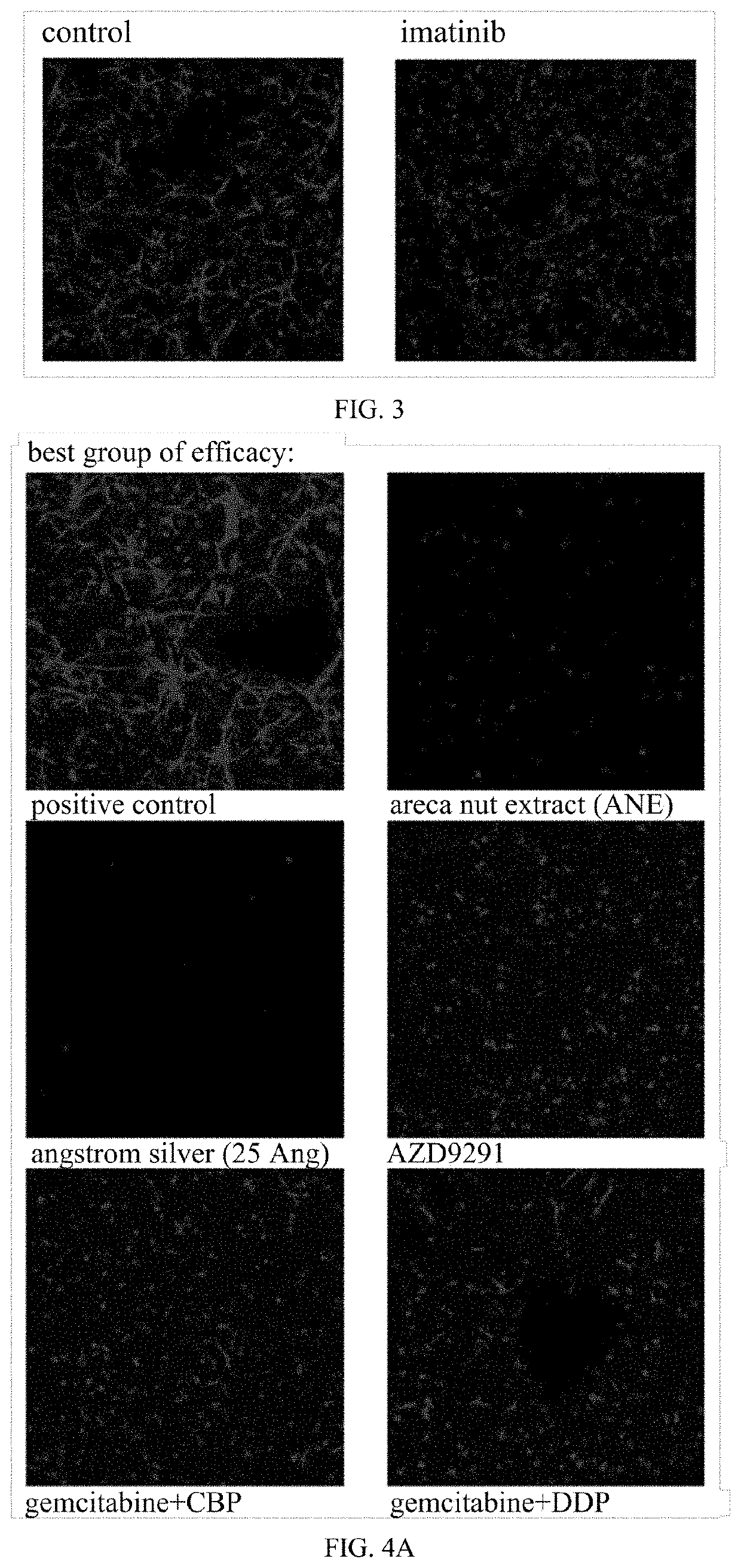 Angstrom silver injection for cancer inhibition, preparation method and application thereof