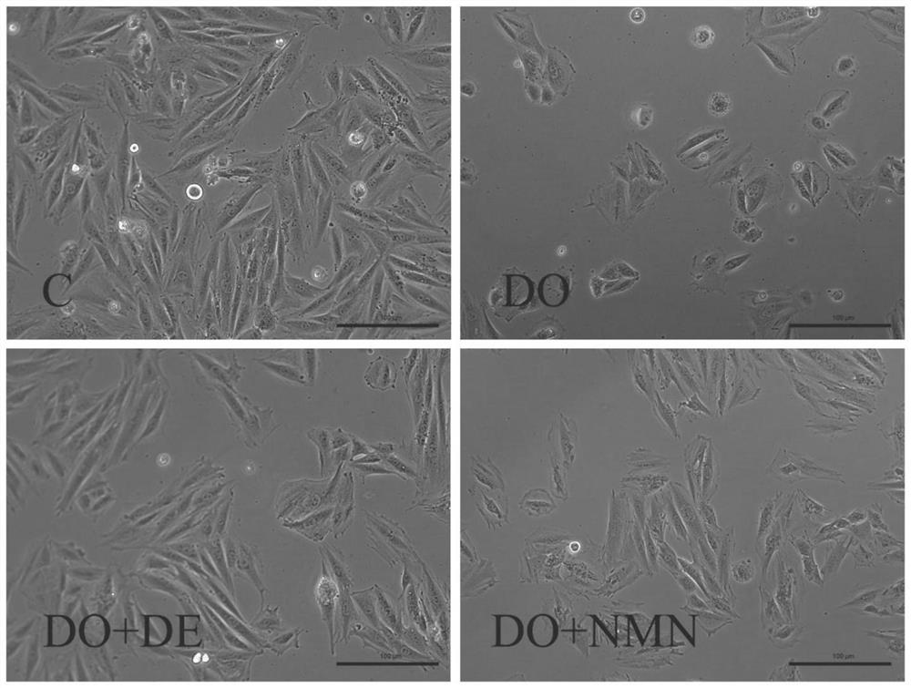 Nicotinamide mononucleotide and protective application thereof in myocardial injury of antitumor drug