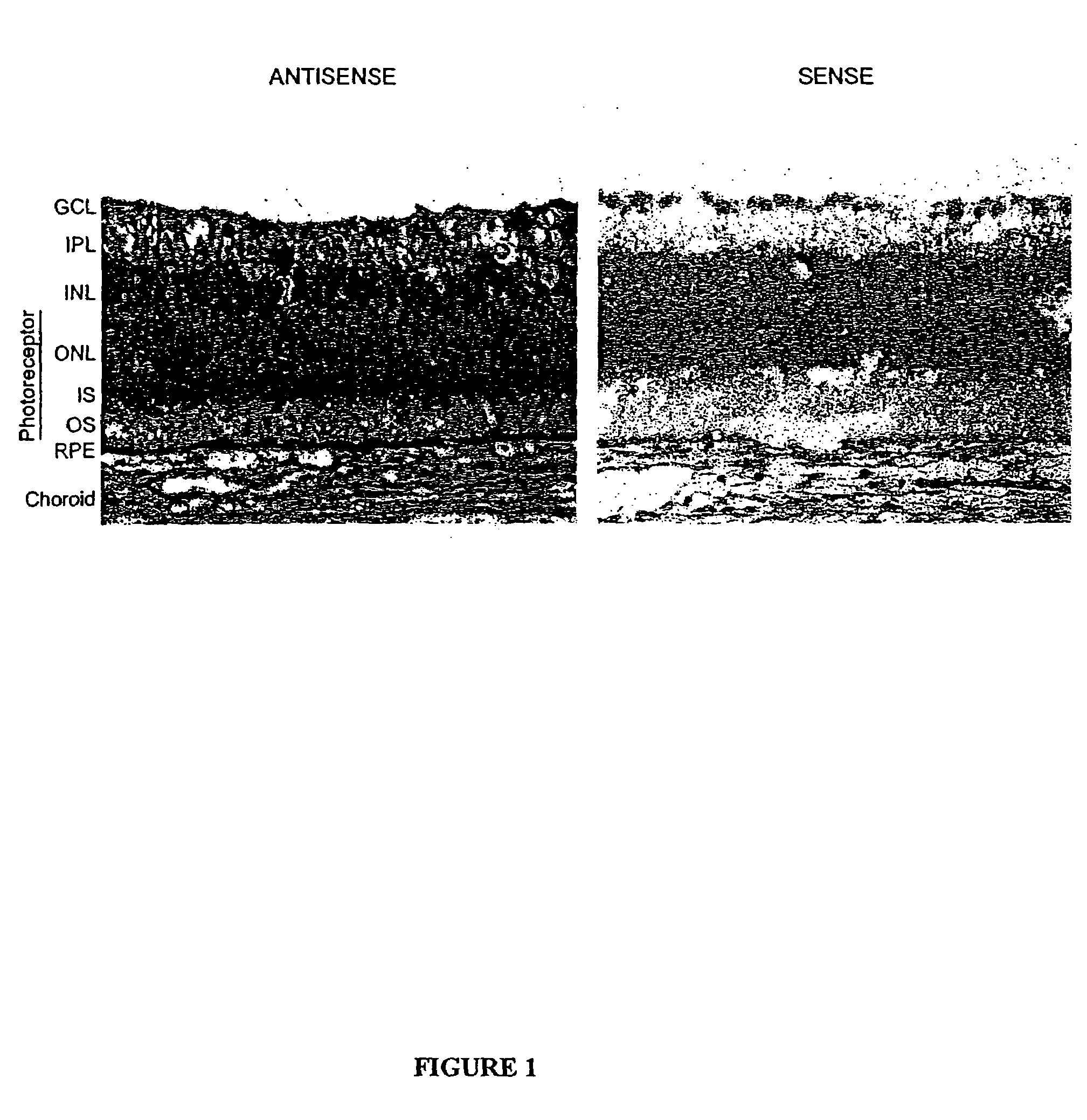 Pharmaceutical formulation comprising dinucleoside polyphosphates and salts thereof