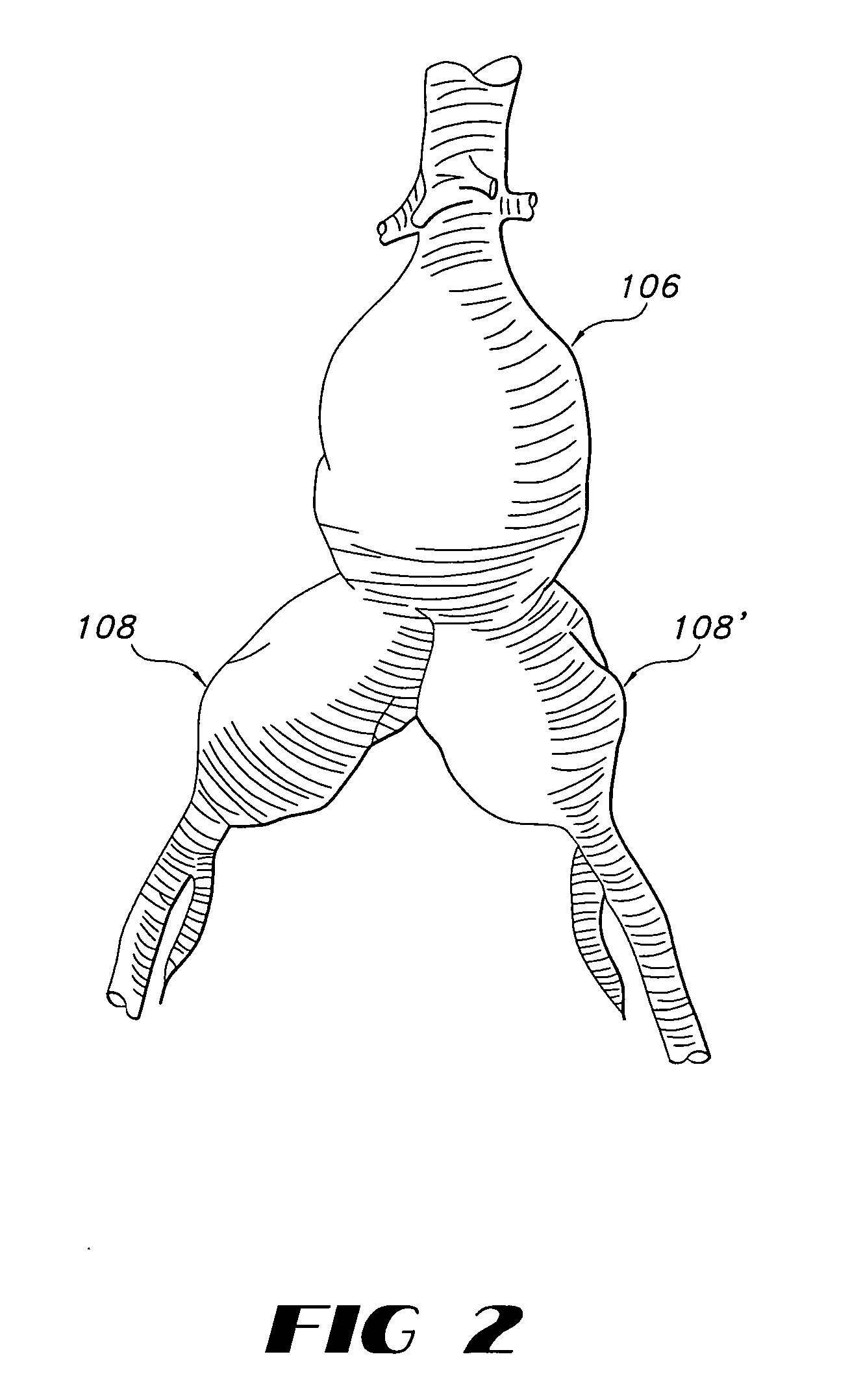 Endovascular prosthetic devices having hook and loop structures
