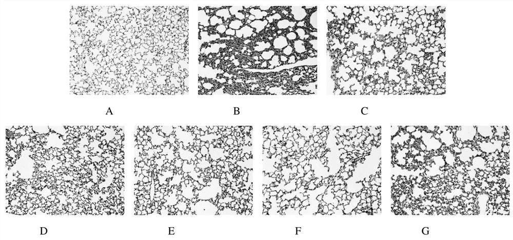 Application of a kind of phycocyanin peptide in the preparation of anti-pulmonary fibrosis medicine
